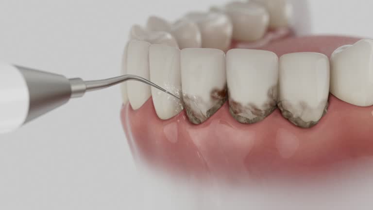 Reliable Dental Implants contractor in Birmingham, AL by Smile Center Dentistry